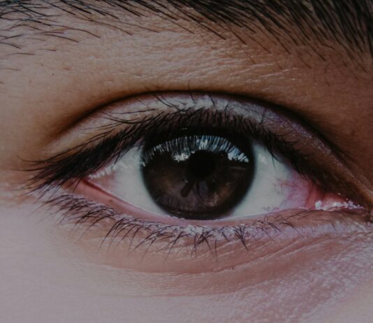 “눈 밑이 칙칙해졌어요”… 다크서클, 단순한 수면 부족이 아닐 수도 있습니다 person's right eye